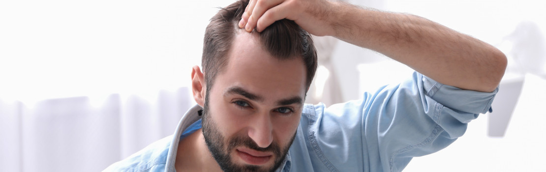 vypadavani-vlasu-u-muzu