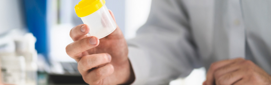 jak-se-pouziva-domaci-test-plodnosti